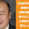 元近鉄の佐野慈紀が感染症のため、右腕切断の手術を受けることを報告と同時に糖尿病の恐ろしさを語る